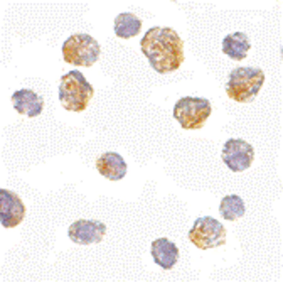 IHC-plus™ Polyclonal Rabbit anti-Human SLC35D1 Antibody (IHC, WB)
