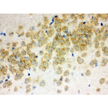 OTOF / Otoferlin Antibody (aa1831-1863)