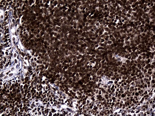 Monoclonal Mouse anti-Human RUNX3 Antibody (clone OTI11D5, Carrier-free, IHC, WB)