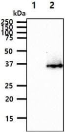 SGCD / Delta-Sarcoglycan Antibody (clone AT19G8)