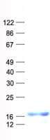 Human C1orf61 Protein (Recombinant His, N-Terminal)