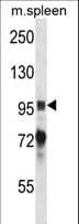 Polyclonal Rabbit anti-Mouse PTK2B / PYK2 Antibody (aa672-701, IHC, WB)
