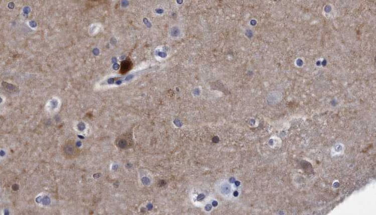 RTN4 / Nogo Antibody