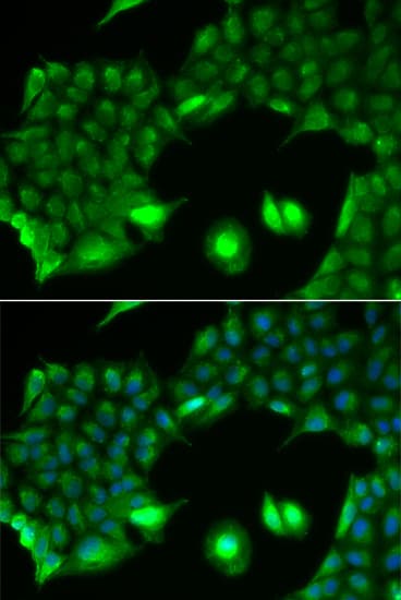 Polyclonal Rabbit anti-Human SSX2 Antibody (IHC, IF, WB)