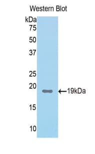 FAH Antibody (aa40-195, HRP)