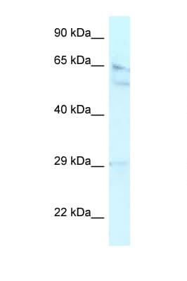 RBBP5 Antibody (aa324-373)