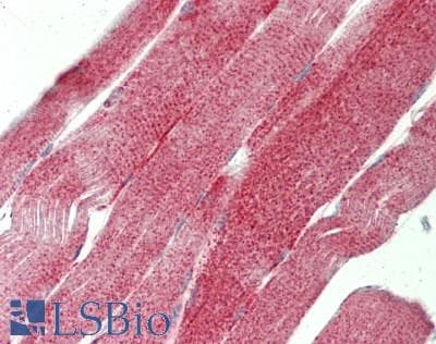 PathPlus™ Polyclonal Rabbit anti-Human HTRA2 / OMI Antibody (aa181-230, IHC)