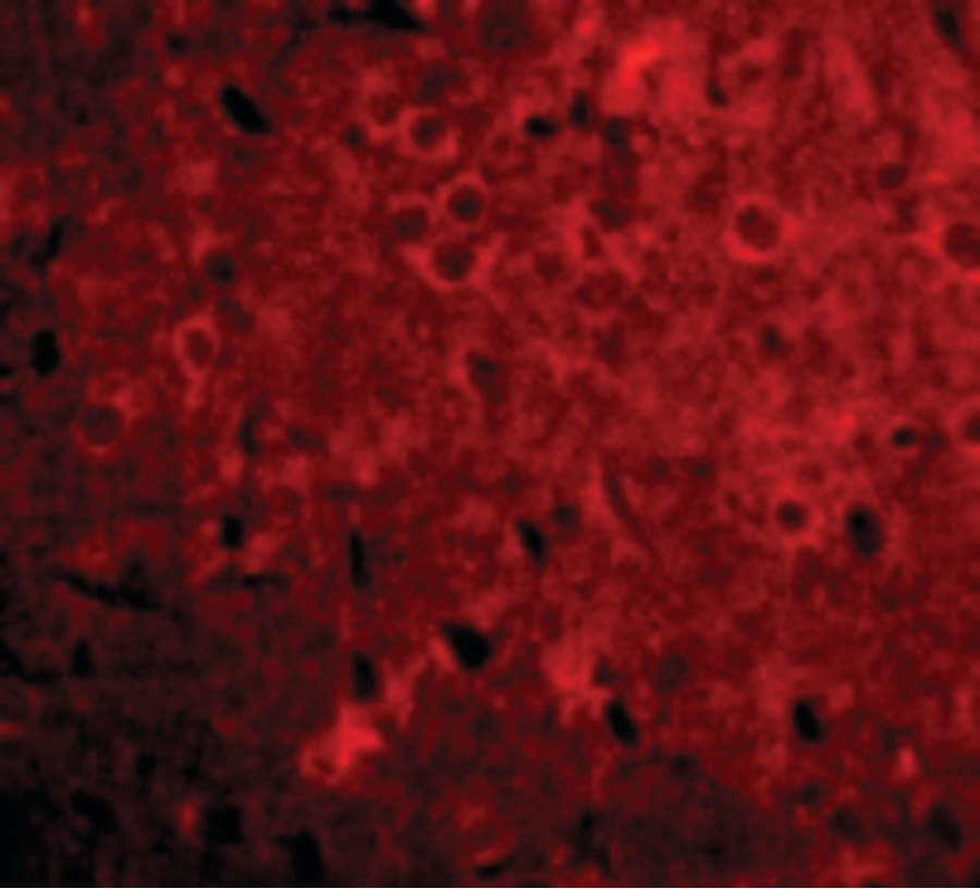 IHC-plus™ GPAM Antibody