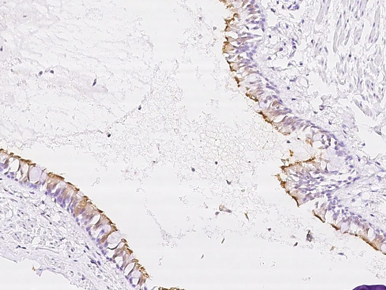 Polyclonal Rabbit anti-Human NME5 Antibody (IHC)