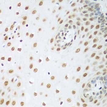 HDAC1 Antibody