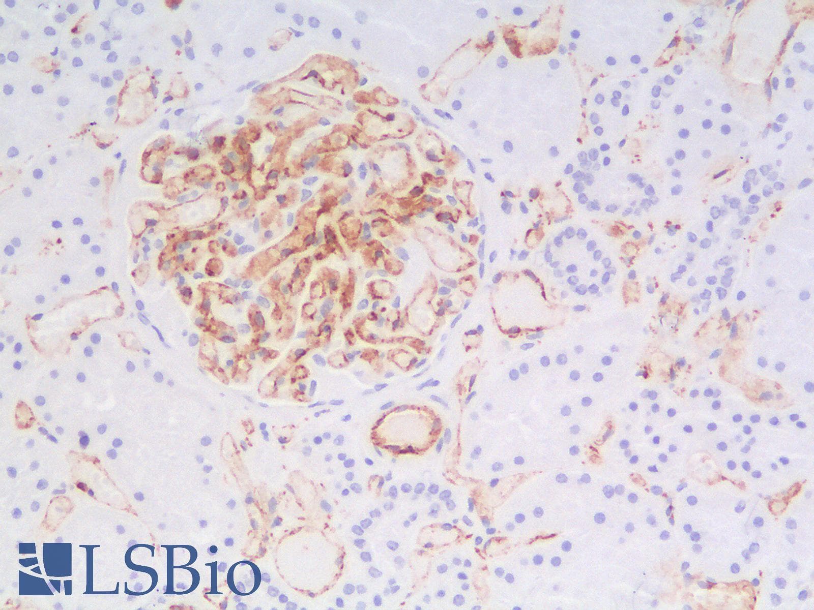PathPlus™ Recombinant Monoclonal Rabbit anti-Human PECAM-1 / CD31 Antibody (clone C31/1395R, IHC, WB)