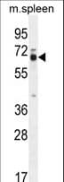 Polyclonal Rabbit anti-Human LMOD2 Antibody (aa60-88, IHC, WB)