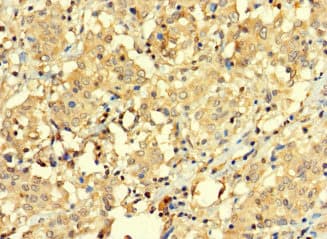 Polyclonal Rabbit anti-Human BAGE3 Antibody