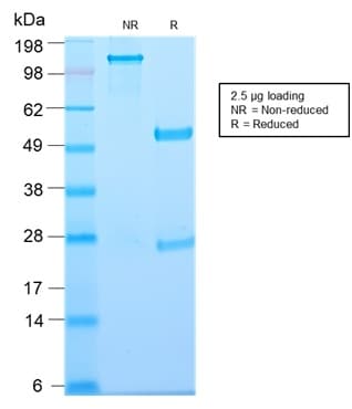 TP / Thymidine Phosphorylase Antibody (clone TYMP/2890R, Azide-free, Carrier-free)