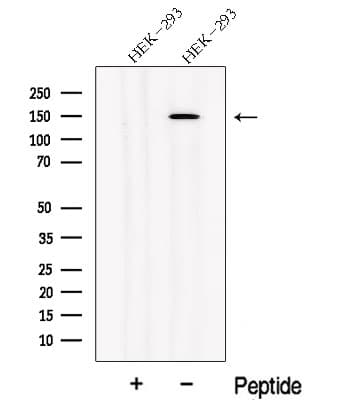 NPHP3 Antibody