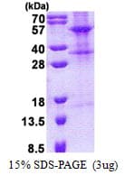 Human TINAGL1 / Lipocalin 7 Protein (Recombinant 6His, N-terminus)