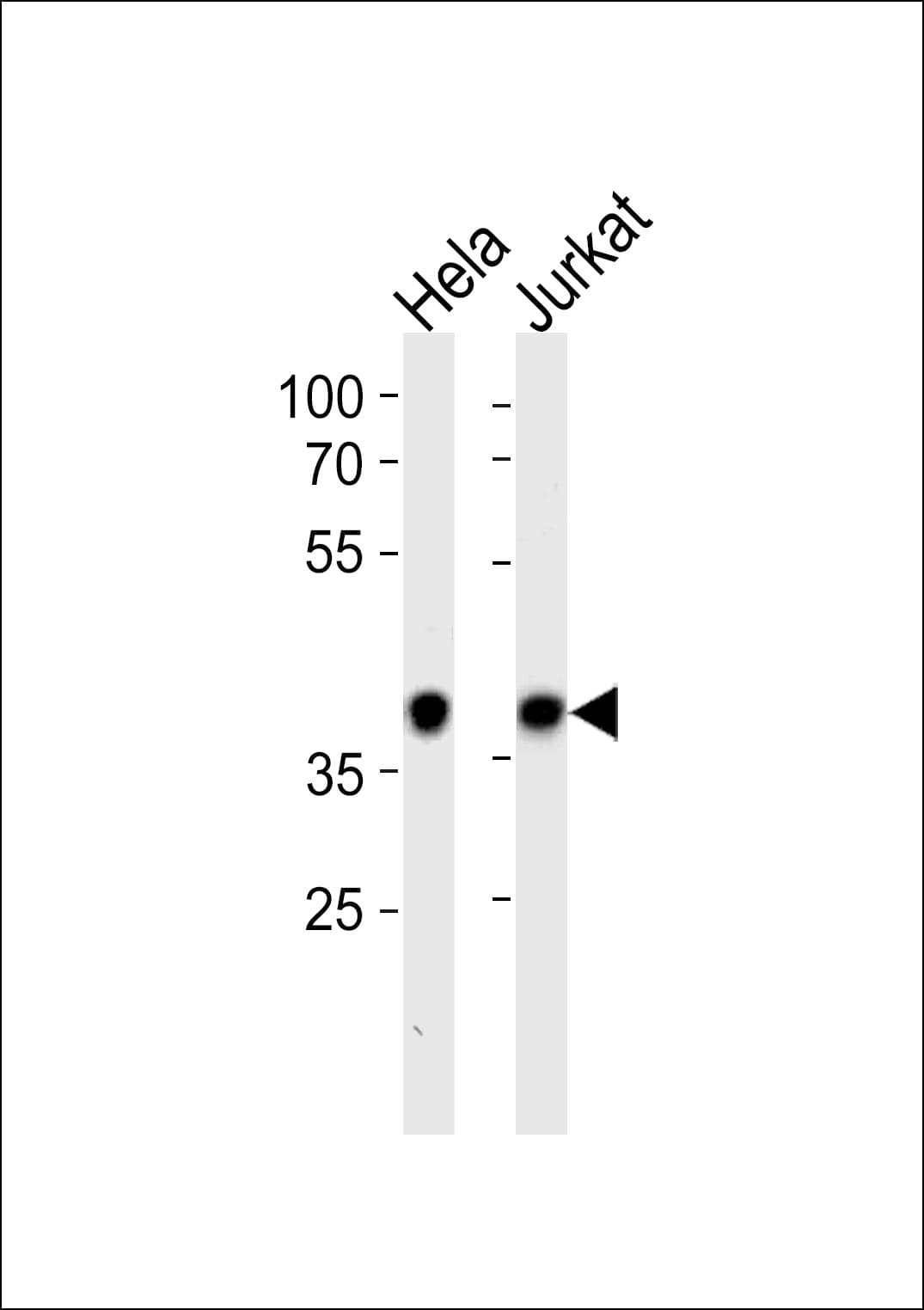 NPM1 / NPM / Nucleophosmin Antibody (aa198-226)