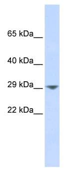 KCNN2 Antibody (aa72-121)
