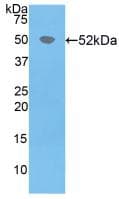 HPRT1 / HPRT Antibody (aa3-218)