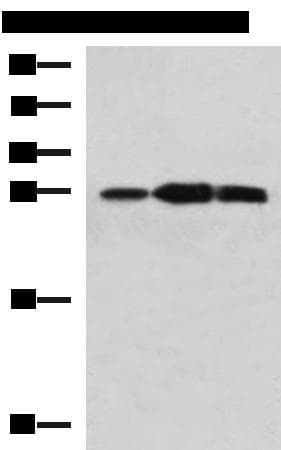 Polyclonal Rabbit anti-Human PLEKHF2 Antibody (IHC, WB)