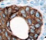 Monoclonal Mouse anti-Human Pan Cytokeratin Antibody (clone OSCAR, Ready-to-Use, IHC)