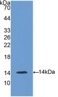 GNRH Antibody (aa22-90)