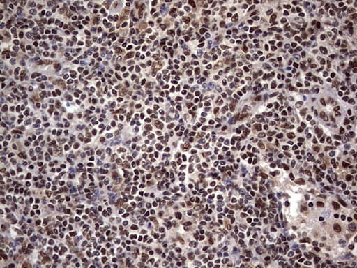 C14orf166 Antibody (clone OTI1E5)