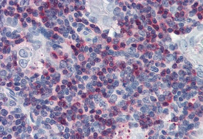 LCP2 / SLP-76 Antibody