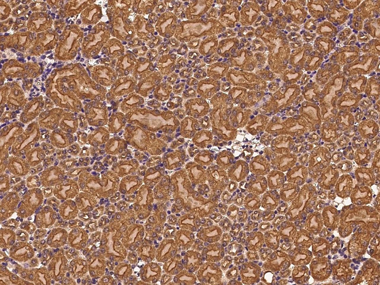 Polyclonal Rabbit anti-Human CLTC / Clathrin Heavy Chain Antibody (IHC, WB)