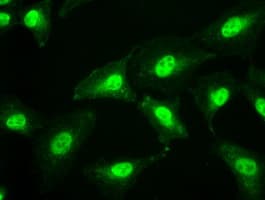 IHC-plus™ Monoclonal Mouse anti-Human SSB / La Antibody (clone 9D6, IHC, IF, WB)