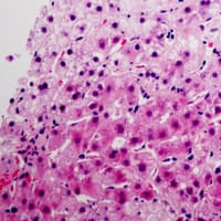 PGC / Pepsin C Antibody (Internal)