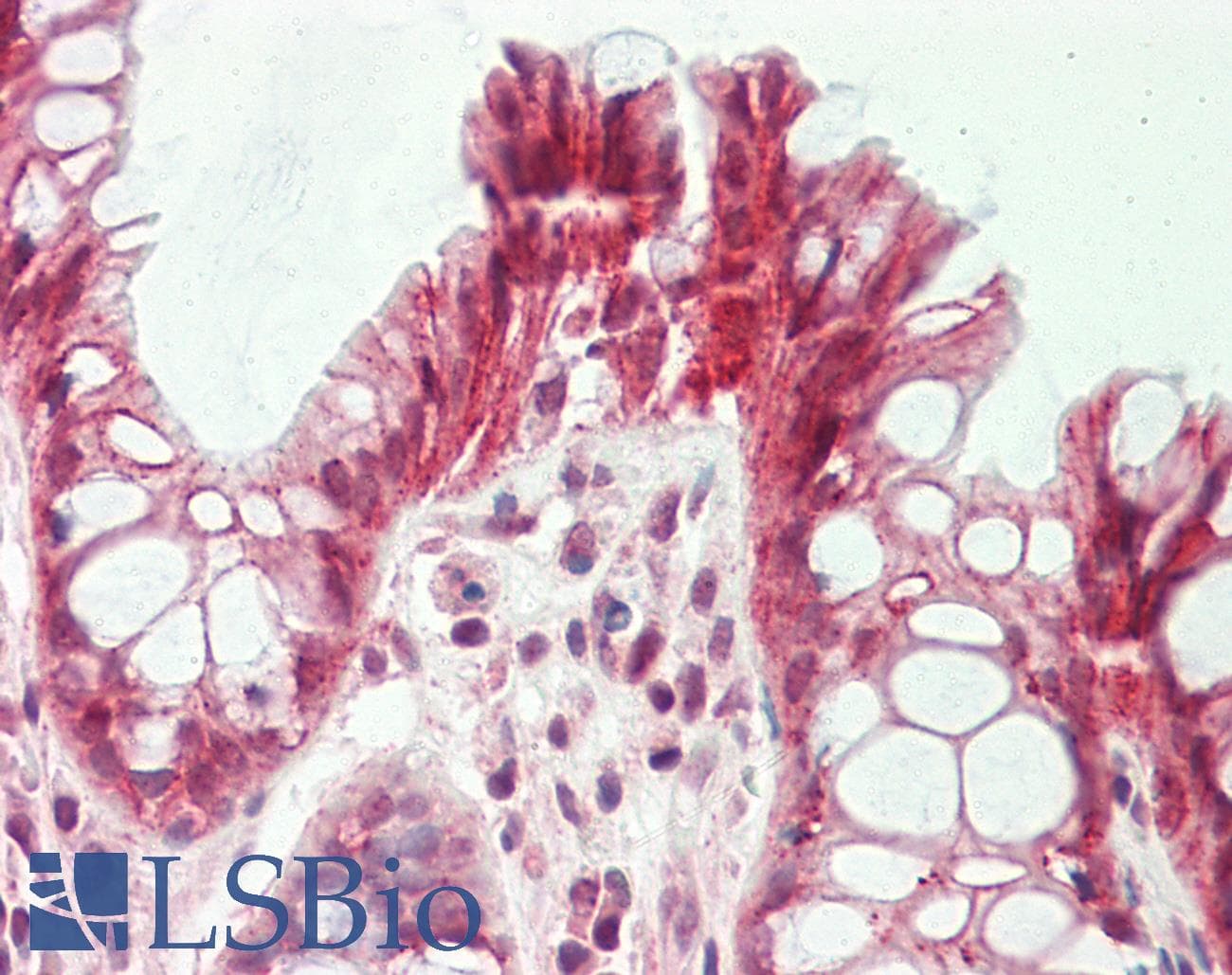 IHC-plus™ FST / Follistatin Antibody (aa312-340)