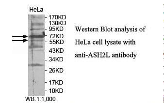 ASH2L / ASH2 Antibody (aa200-380)