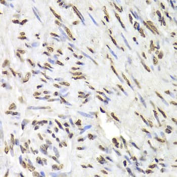 Polyclonal Rabbit anti-Human HNRNPD / AUF1 Antibody (IHC, WB)