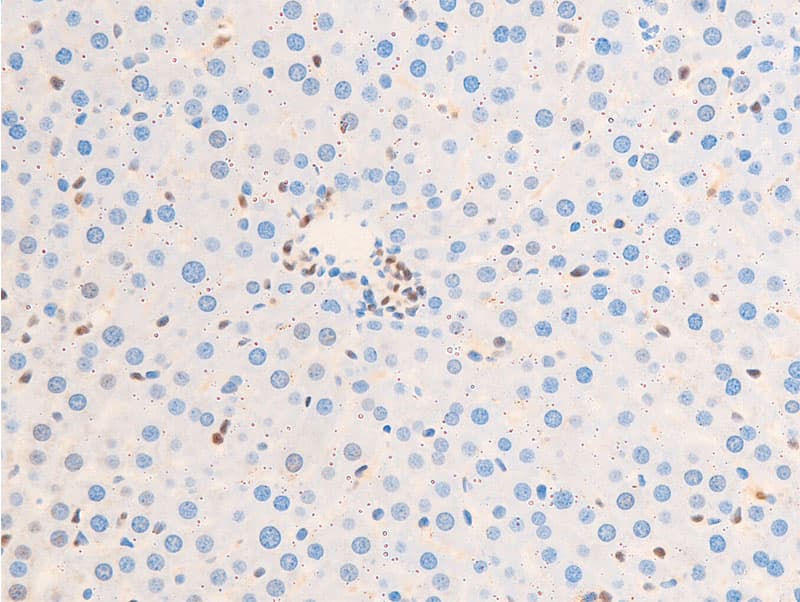 JUN / c-Jun Antibody (phospho-Ser63)