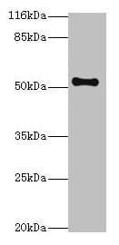 NR1A2 / THRB Antibody (aa1-461)