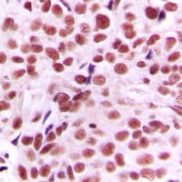 MYC / c-Myc Antibody (N-Terminus)
