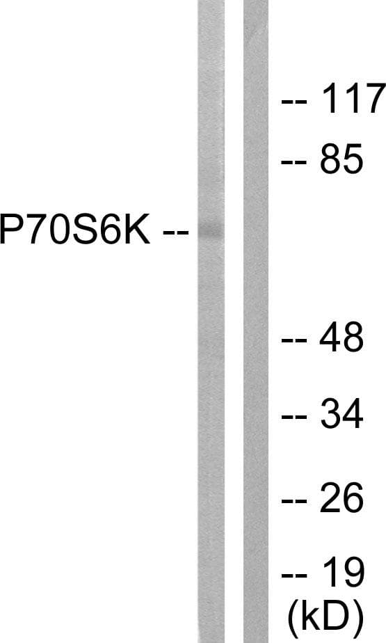 RPS6KB1 / P70S6K / S6K Antibody (p371)