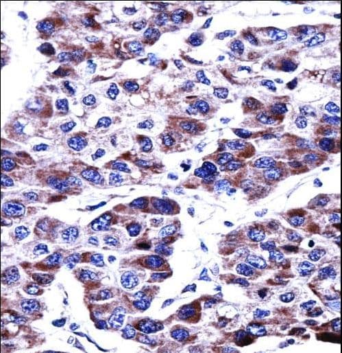 Polyclonal Rabbit anti-Human DUSP9 Antibody (aa300-329, IHC, WB)