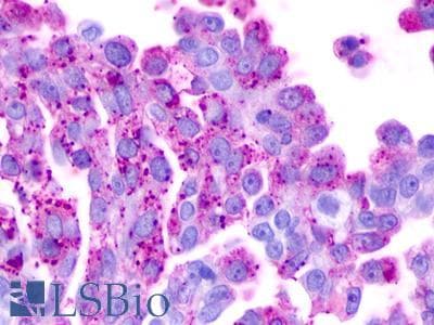 PathPlus™ Polyclonal Rabbit anti-Human GPR183 / EBI2 Antibody (Extracellular Domain, IHC)