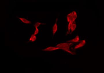NFKB1 / NF-Kappa-B Antibody (phospho-Ser932)