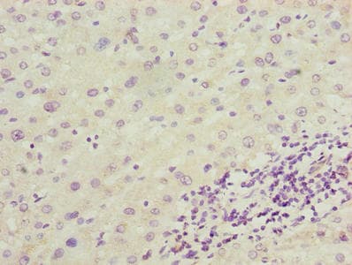 Polyclonal Rabbit anti-Human ENO1 / Alpha Enolase Antibody (IHC, WB)