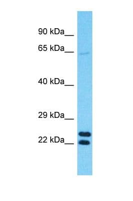 Polyclonal Rabbit anti-Human TMEM39B Antibody (N-Terminus, WB)