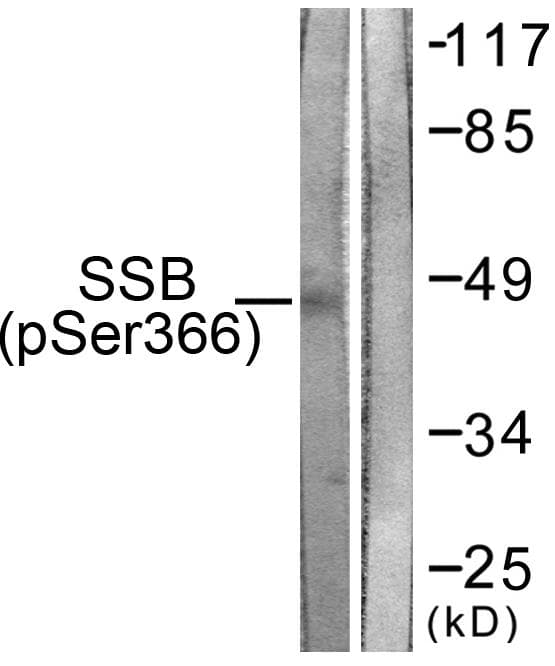 SSB / La Antibody (phospho-Ser366)