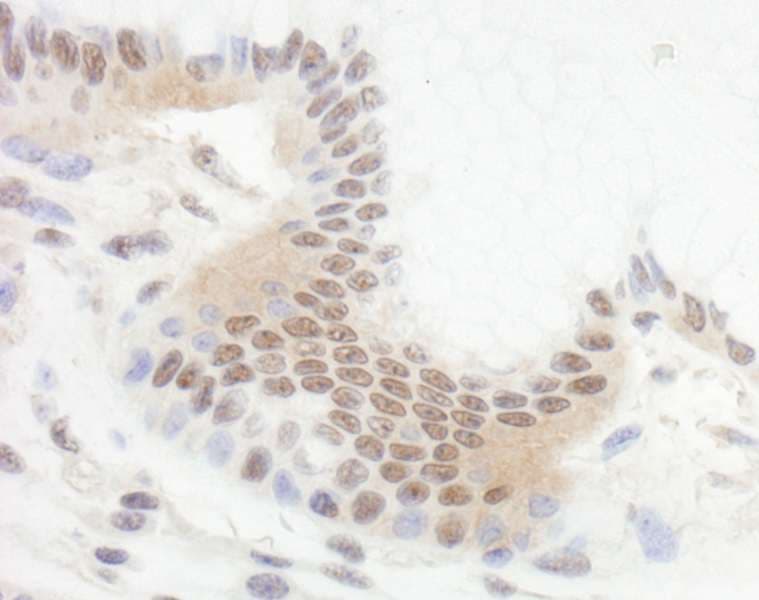 BCL11B Antibody (aa500-550)