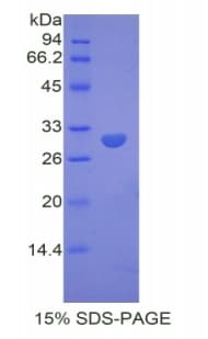 Mouse DMD / Dystrophin Protein (Recombinant His)