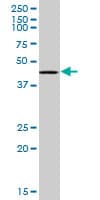 RING1 Antibody (clone 4E8)