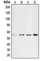 Polyclonal Rabbit anti-Human CD4 Antibody (C-Terminus, WB)
