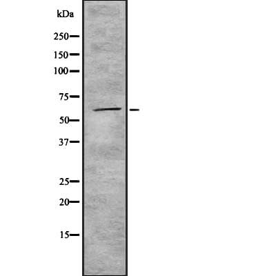 Polyclonal Rabbit anti-Human CYP4F22 Antibody (WB)