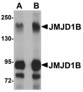 IHC-plus™ Polyclonal Rabbit anti-Human KDM3B / JMJD1B Antibody (IHC, IF, WB)